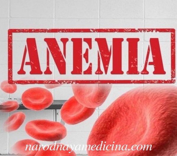 Что это такое анемия? В чем опасность болезни